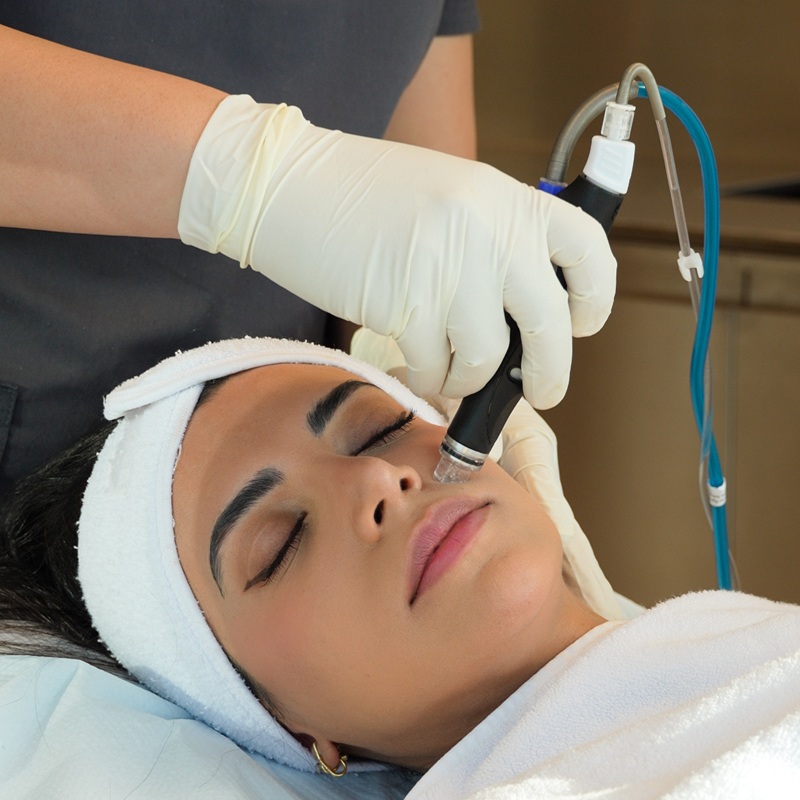 Hydrafacials
